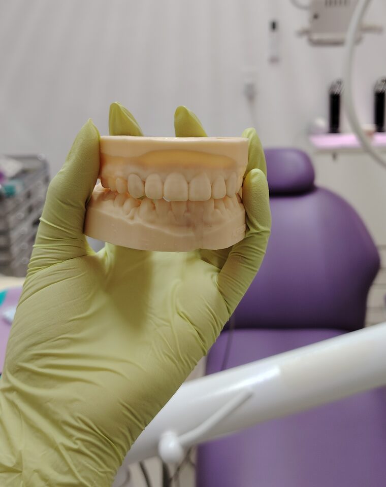 Manos con guantes sosteniendo un modelo dental en el consultorio de KineDenta
