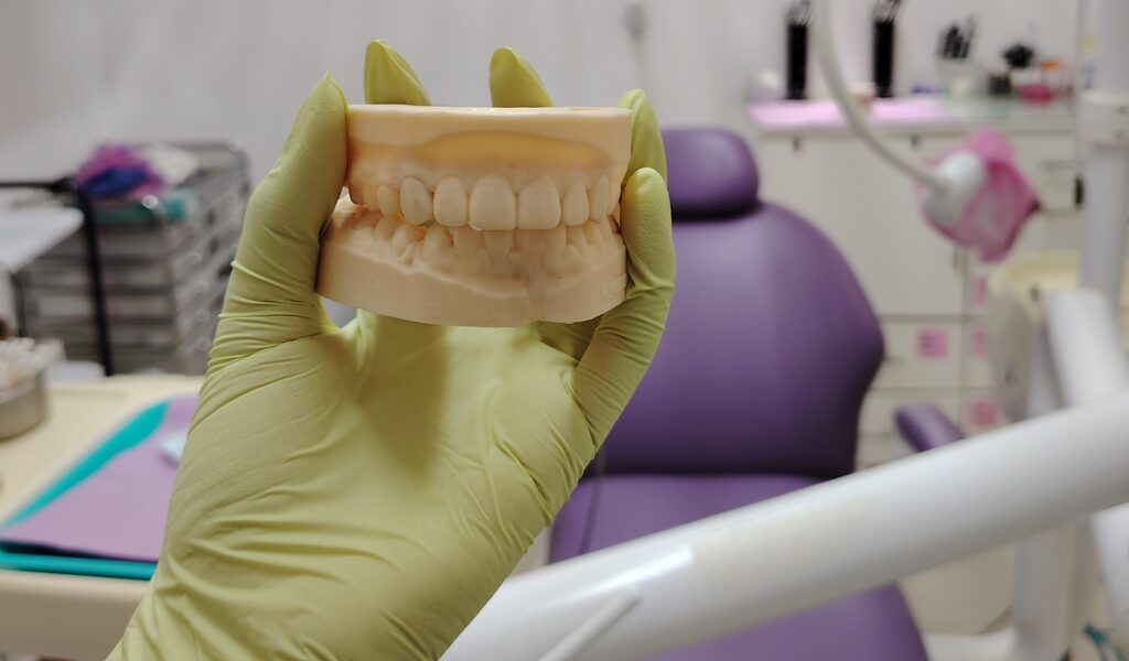 Modelo dental de estudio sostenido con guantes frente al sillón del consultorio de KineDenta